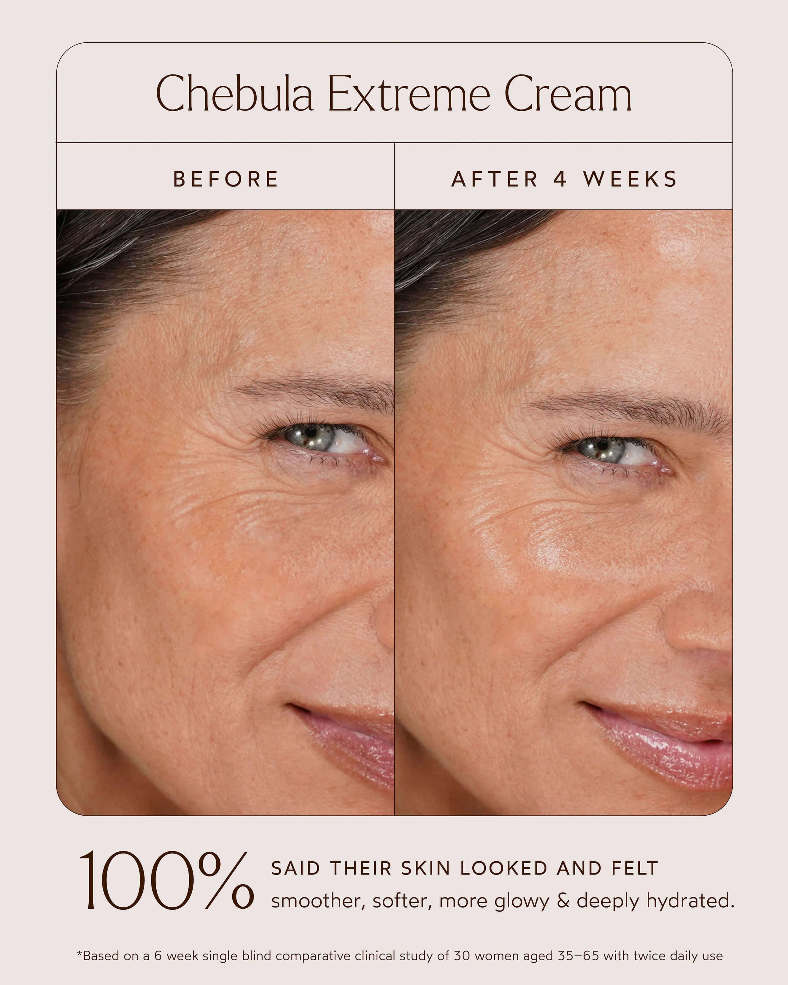 Chebula Extreme Cream 10